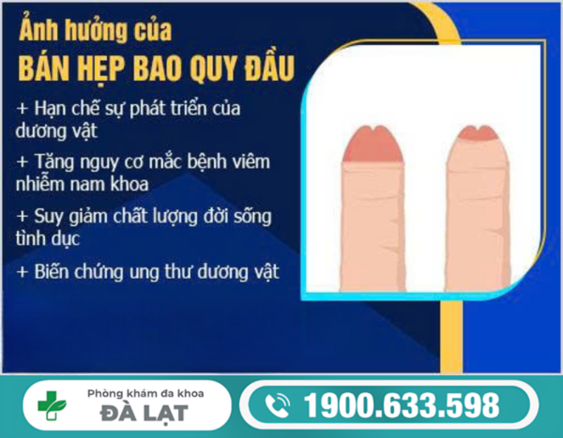 Hình ảnh minh họa